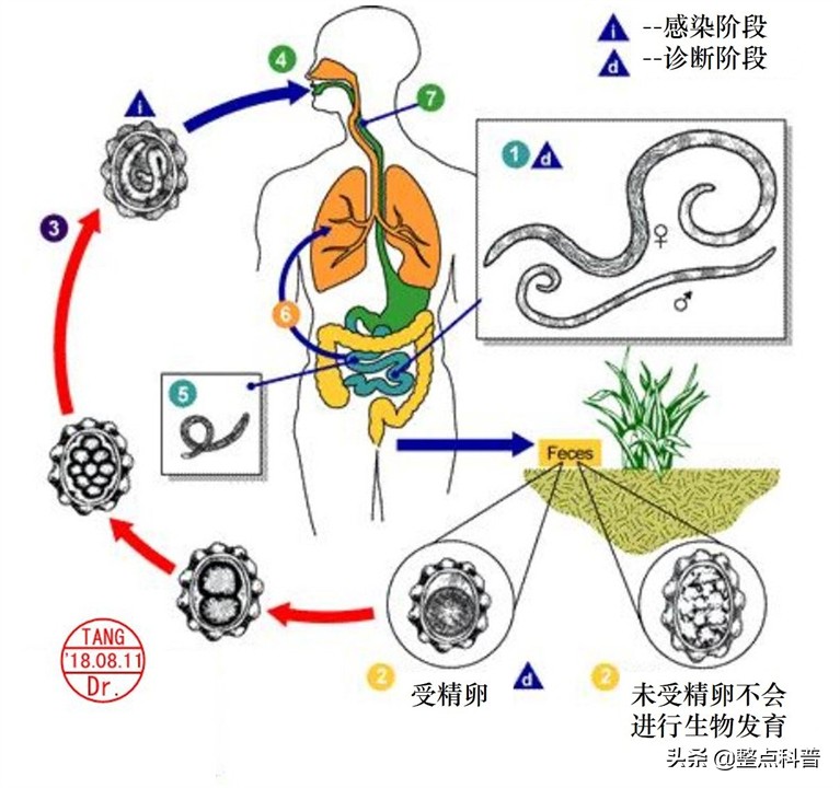 现在怎么没听说了(几十年前，几乎人人肚子里都有的蛔虫，为什么现在没有听说过了？)