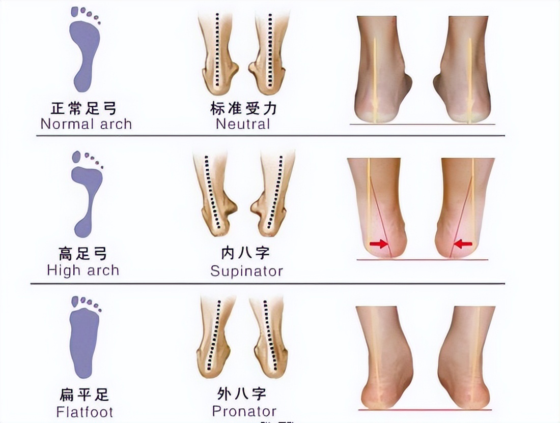 短跑能穿篮球鞋吗(跑步者最容易忽略的问题：跑步鞋的坡差)