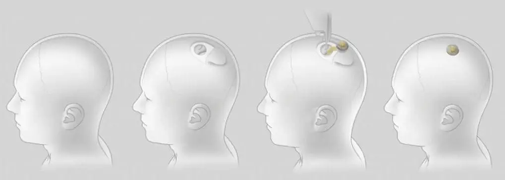 马斯克公司回应残忍虐猴,动物实验什么时候是个头?