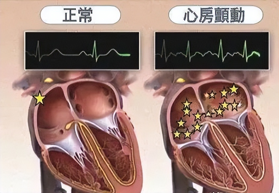 高血压的7大危害！如果您全知道，那就别点进去看了