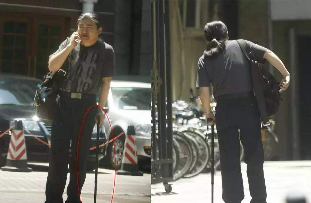 有苦难言的8位明星，多年顽疾缠身，有人成身体缺陷抱憾一生