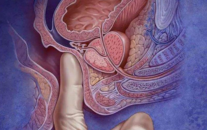 痔疮与直肠癌，该如何正确区分？医生精准分析，看完明白了