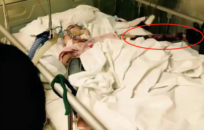 徐婷：26岁全身溃烂而死，被全家人吸干最后一滴血，从未想过反抗