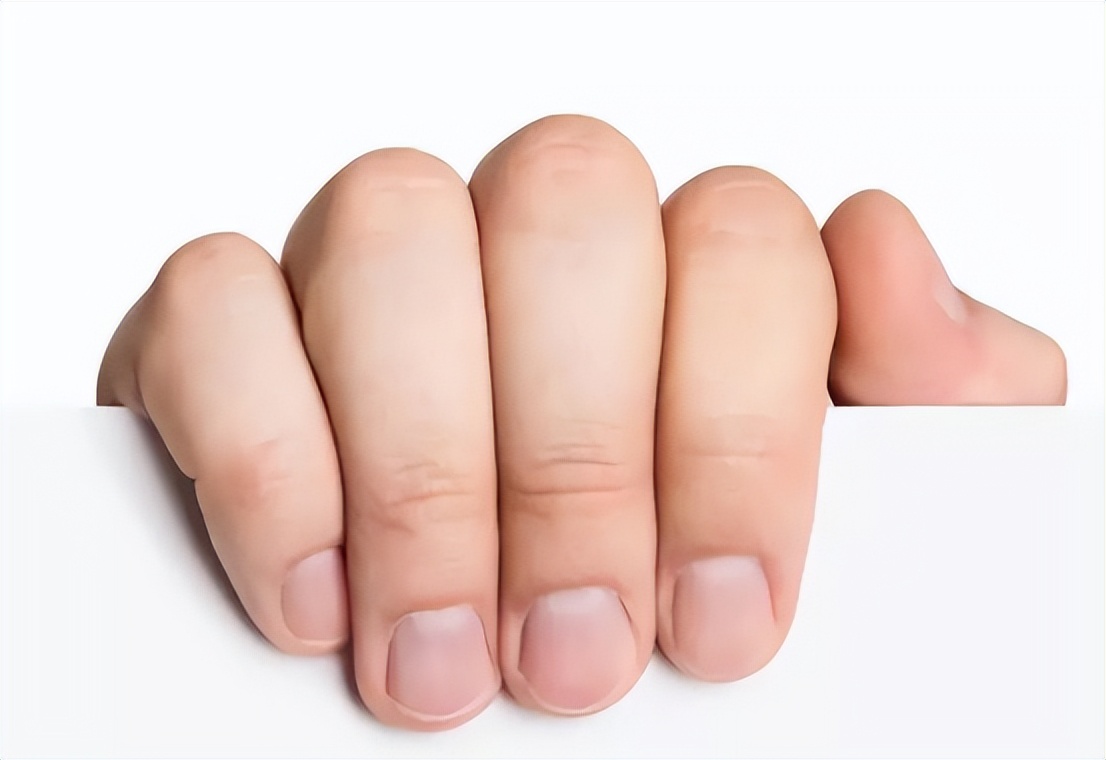 指甲盖上有竖纹,这是咋回事?真是老人说得"肝脏不好"?