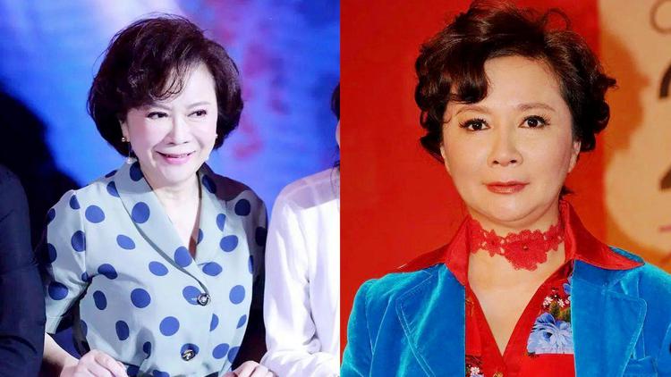 如今的蔡明已经62岁了,虽然脸上没有什么皱纹,但是却显得异常僵硬,这