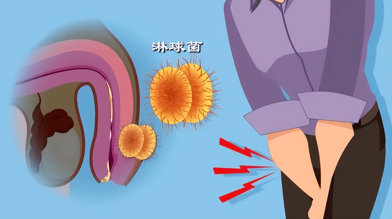 怎么判断自己有没有性疾病 一招判断自己感染了新冠病毒-百联百科