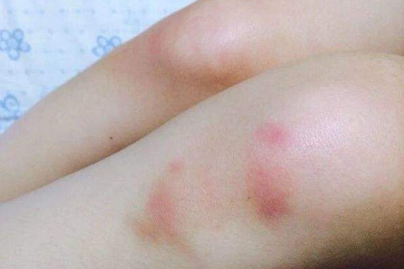 孩子在学校被欺负该“打回去”吗？父亲高情商反击，引家长称赞