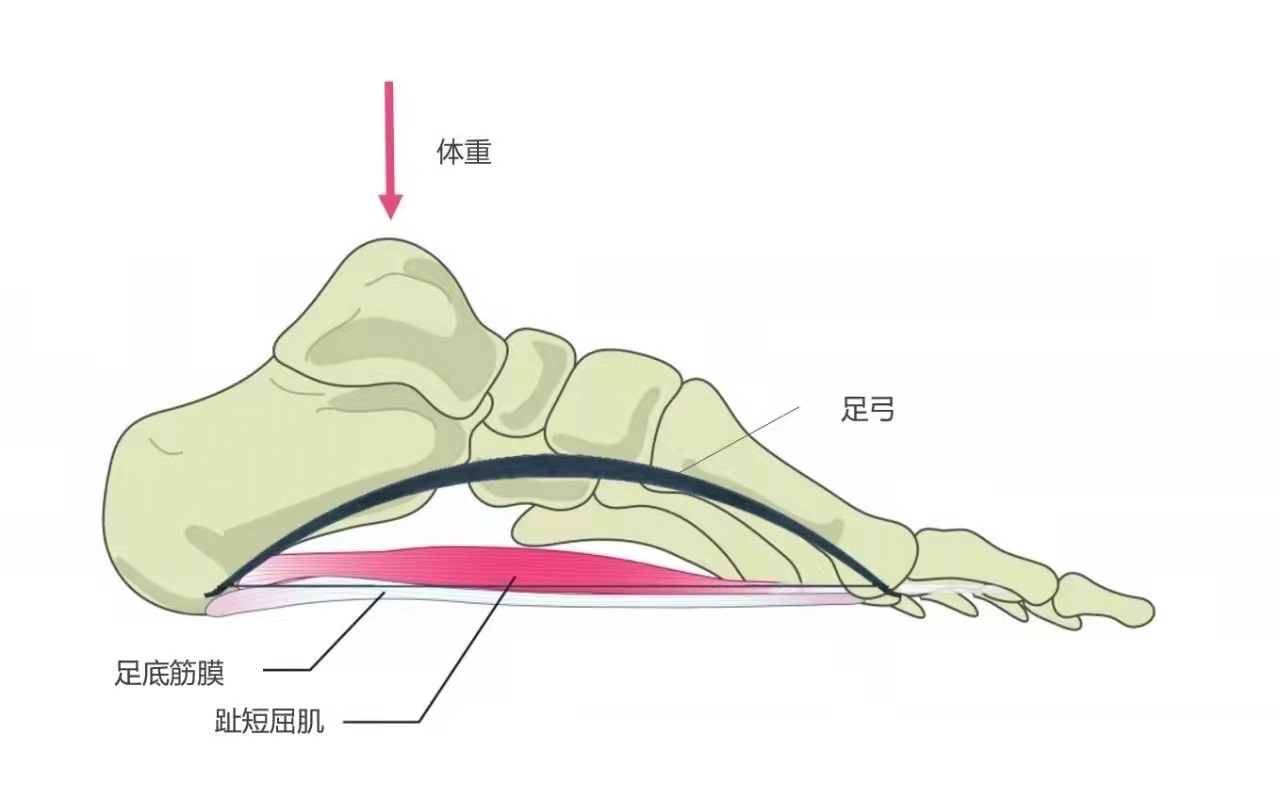 穿跑鞋走路足弓疼(运动过量容易引起足底筋膜炎，出现足跟痛，要怎么办？)