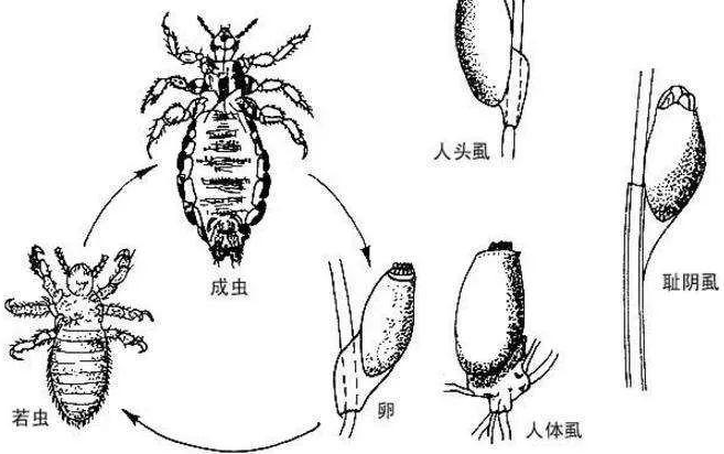 Bret(这是真的！与人类共存，活上千万年了，为何虱子现今很难见到了？)