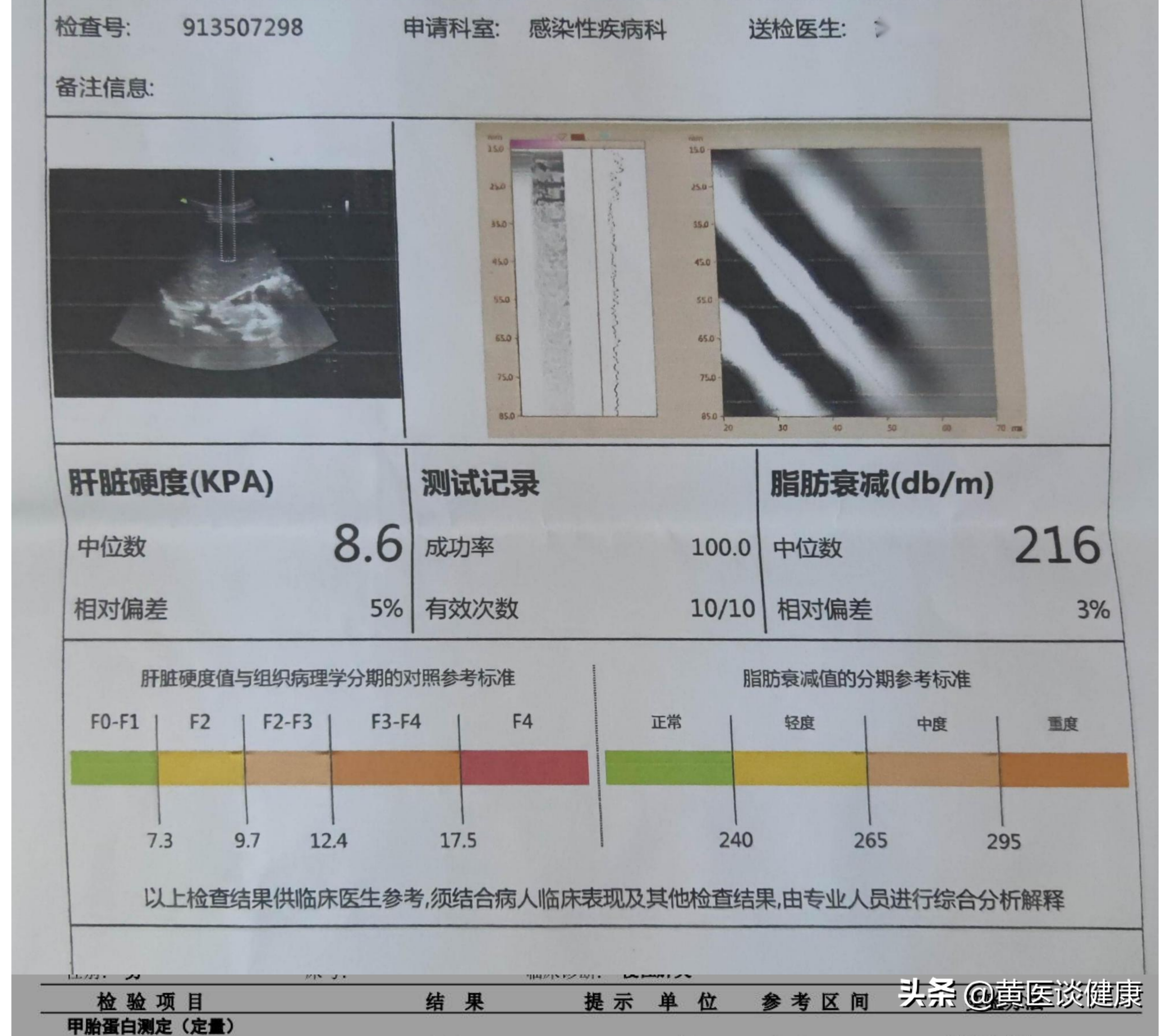 若转阴将恢复训练(乙肝抗病毒治疗后，如何知道病情好转，要做哪些检查？)