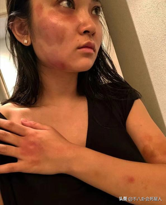 表面恩爱，实际“拳头相向”，从黄奕到黄嘉千，被最亲近的人伤害