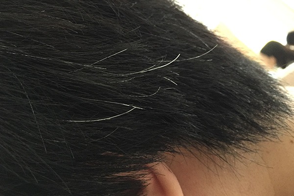 白头发越来越多，怎么回事？年纪轻轻就出现白发，或和2件事有关