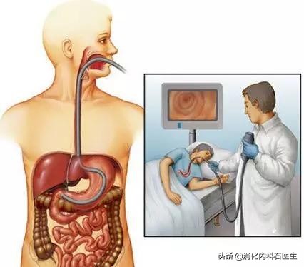 男子胃镜检查后大出血住院，医生活检为啥这么随意？责任谁来负？