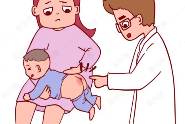 孩子肛门脱出的小肉块,家长们你们注意过吗?要注意哪些方面呢?