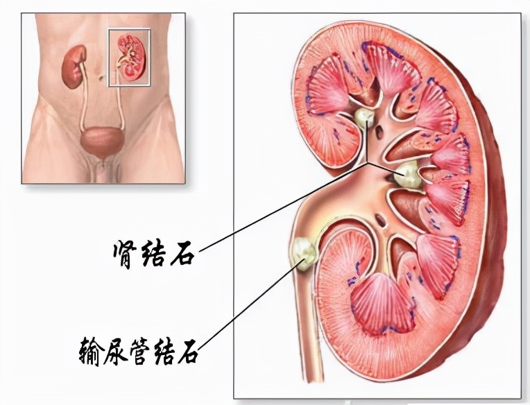 这些疾病的疼痛程度不亚于古代的酷刑，看完你还敢得病吗