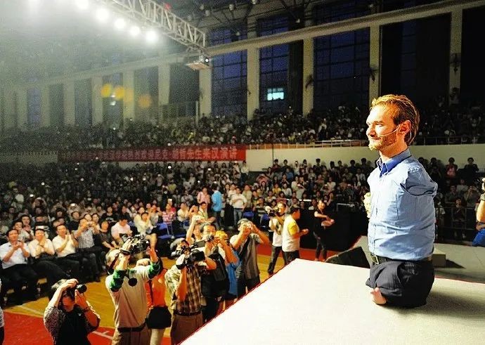 在医学界有一种天生疾病名叫"海豹肢症",正如它的名字一样,患者身形