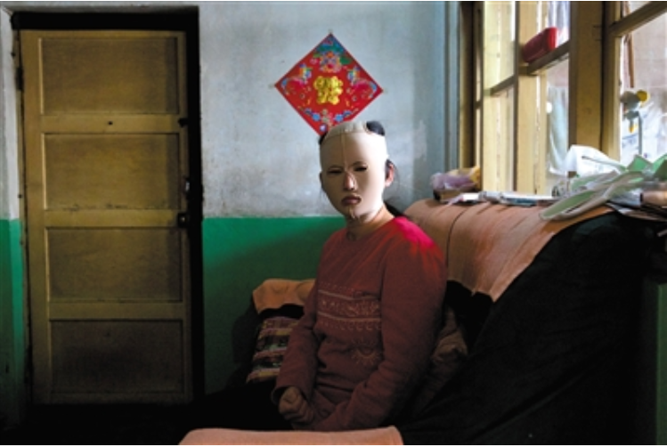 8年前，这个中国姑娘去韩国整容后，她的人生差点被毁掉