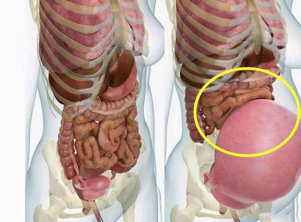 这些内脏被增大的子宫挤压,缩成了一团.