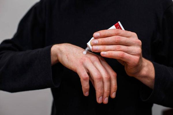 当有了皮肤癌的症状后，不能忽视不管，除了治疗外，还要做好4点