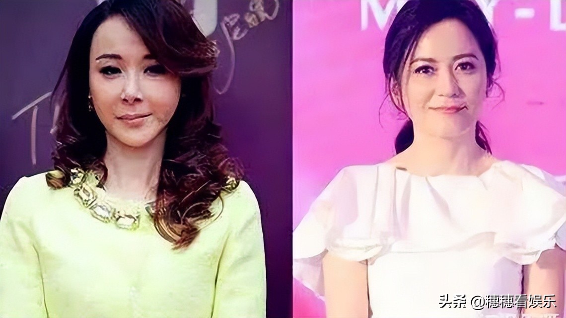 十年前你比我美，十年后谁美就不一定了，看明星们的变美史