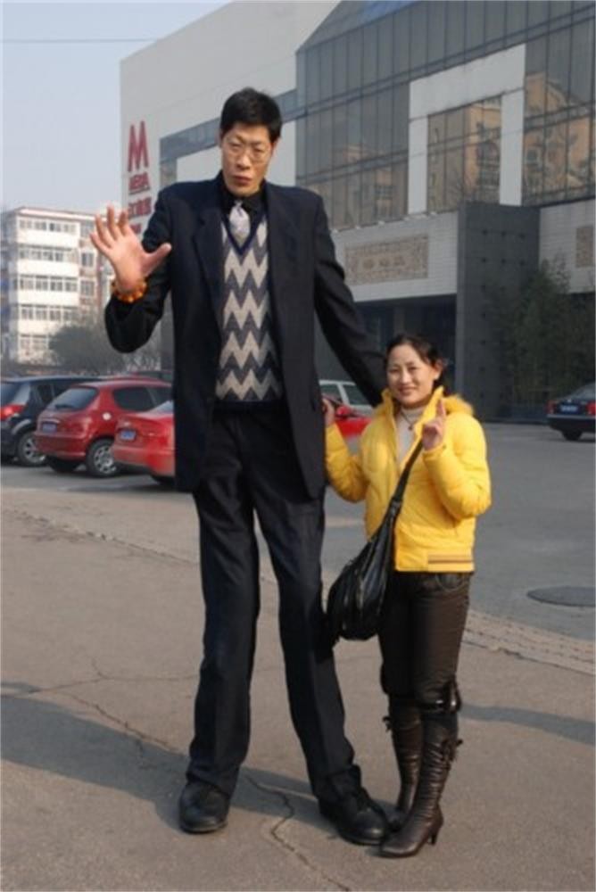 经过医生检查,确定张俊才患上了巨人症,需要立刻进行手术.