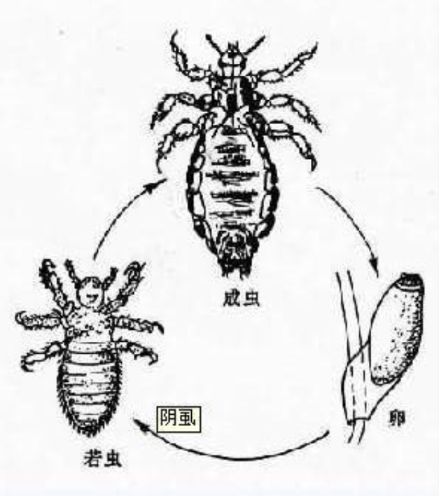 6722岁小伙长虱子,治,排毒花费近8万元,为什么会有虱子?