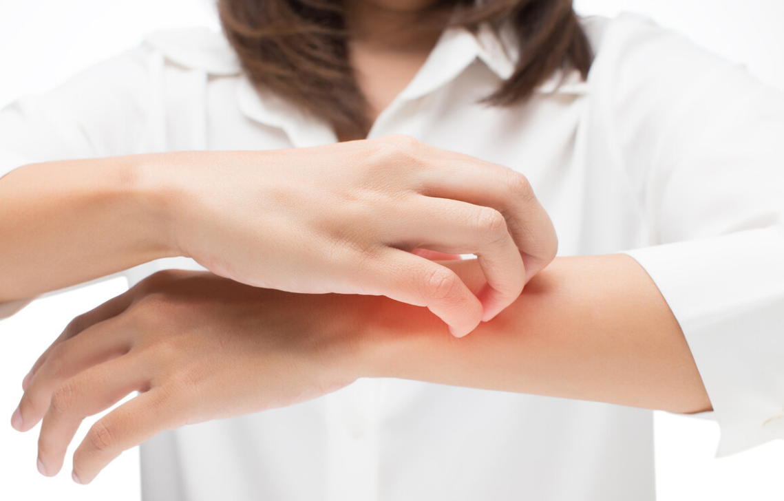 被蚊子咬了怎么止痒消肿(蚊虫叮咬,最止痒的办法竟如此简单!