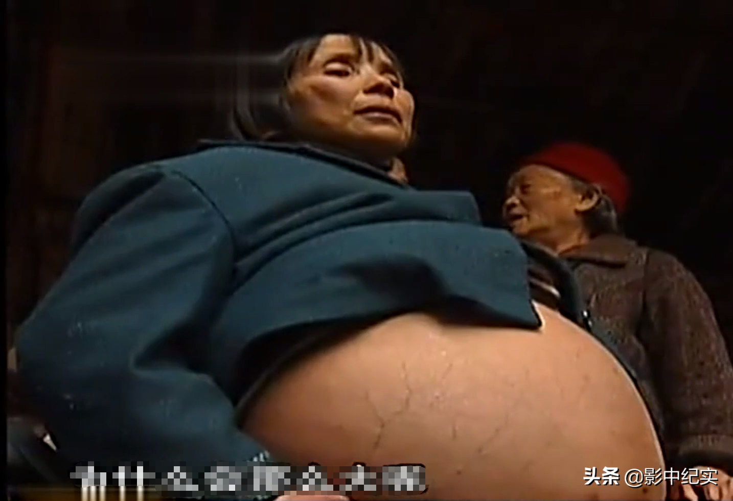 社会人真实拿刀照片(2011年，重庆女子拿刀划开自己肚子，只因自身得了怪病没钱医治)