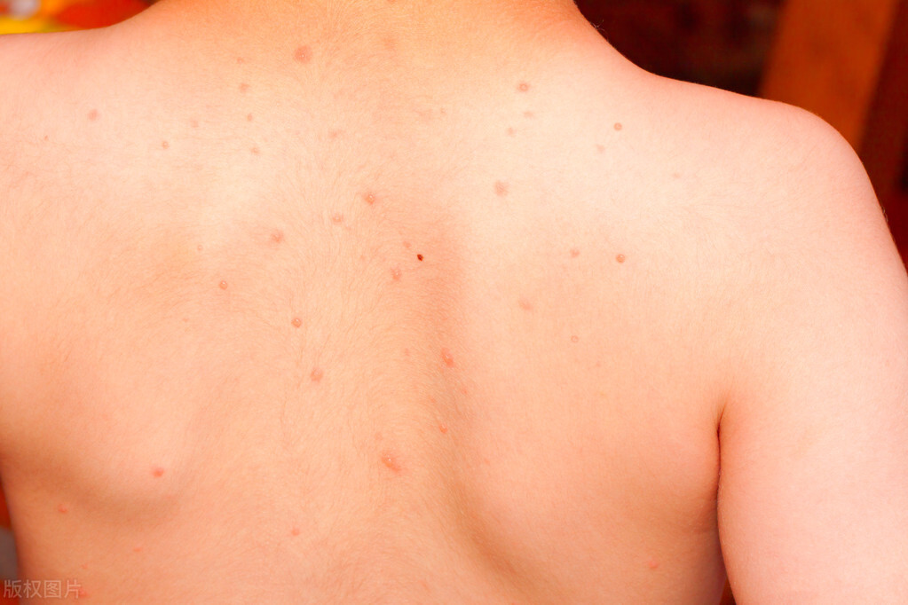 艾滋病图片(艾滋病图片宣传) - 盾灵网