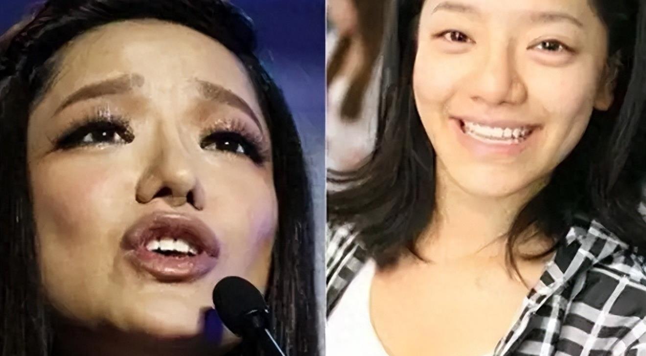 曾是超女冠军,却因整容失败像“怪物”,全身只剩下眼珠是自己的