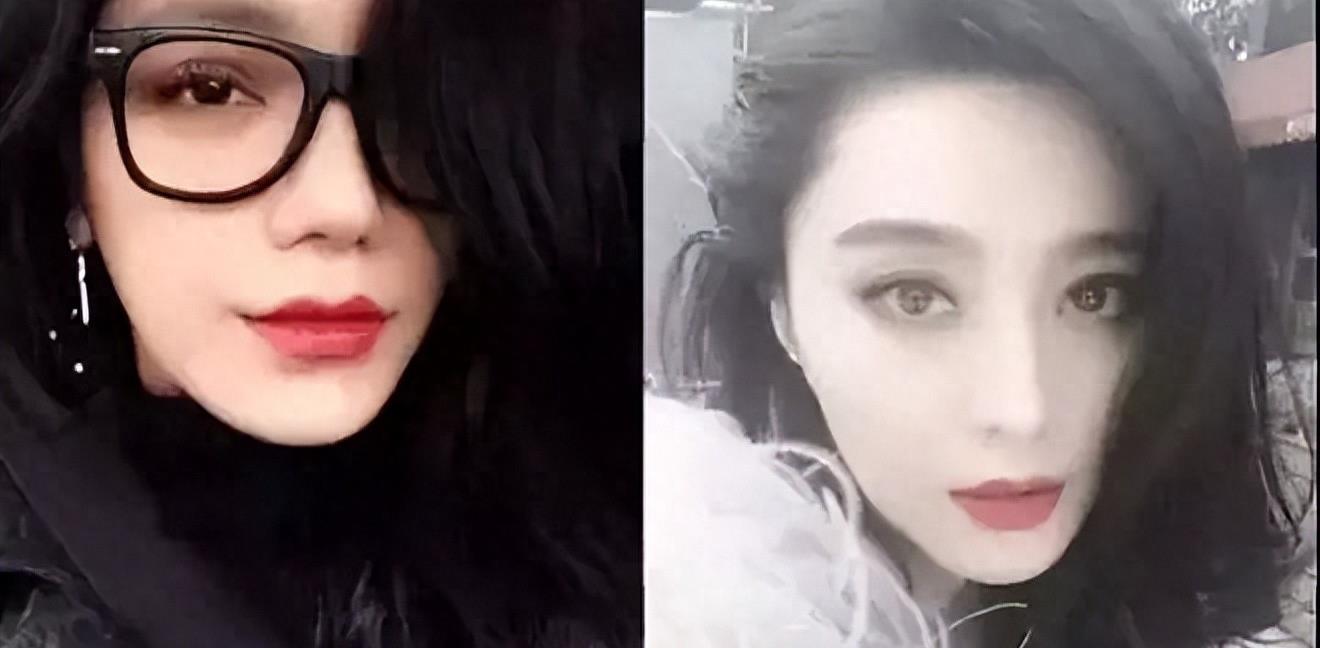 曾是超女冠军,却因整容失败像“怪物”,全身只剩下眼珠是自己的