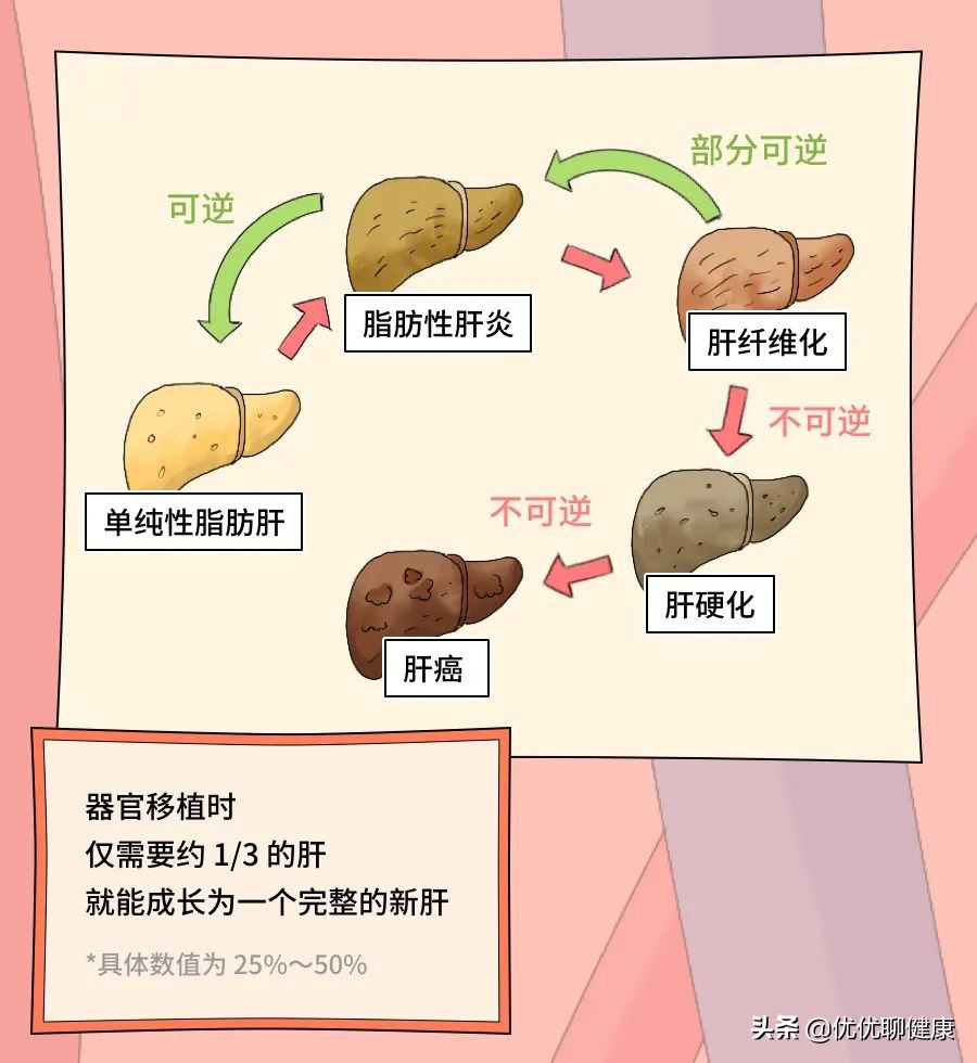 肝就是这样被你累死的