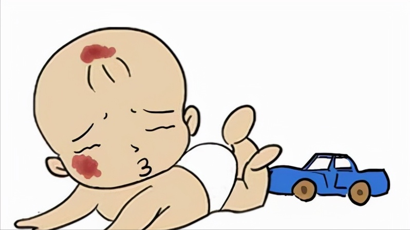 婴儿头上血管明显图片(婴幼儿血管瘤vs先天性血管瘤) - 乐宝宝贝