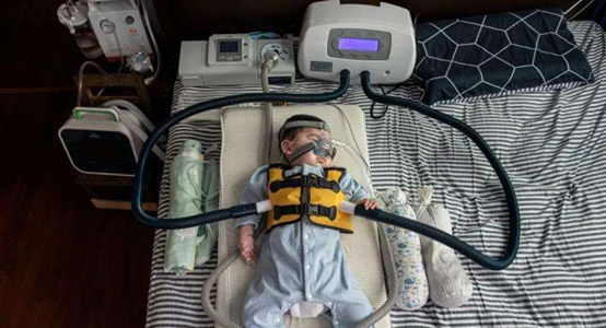 一般在三十岁以后发病;而sma表现为肌肉疲软,且患者在六个月左右的