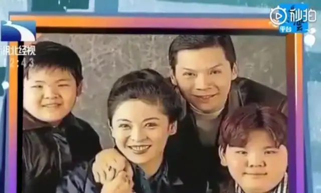 有种“整容”叫郭碧婷结婚,老公向佐变化不大,她却像换个人
