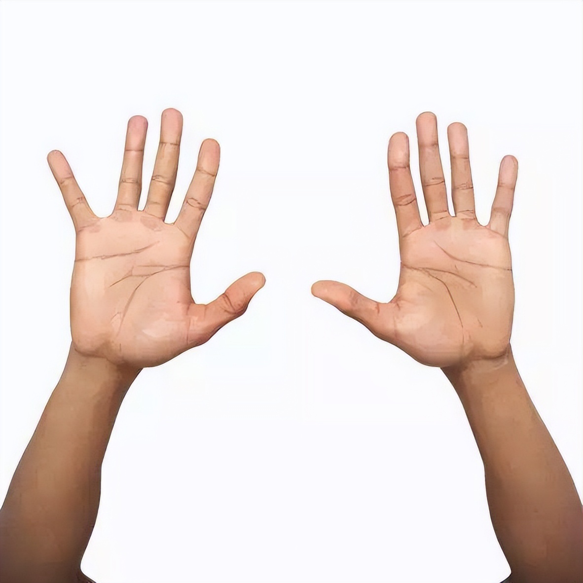 "横纹",表现就是手掌上有一条掌纹贯通左右,属于手部纹路的一种特殊