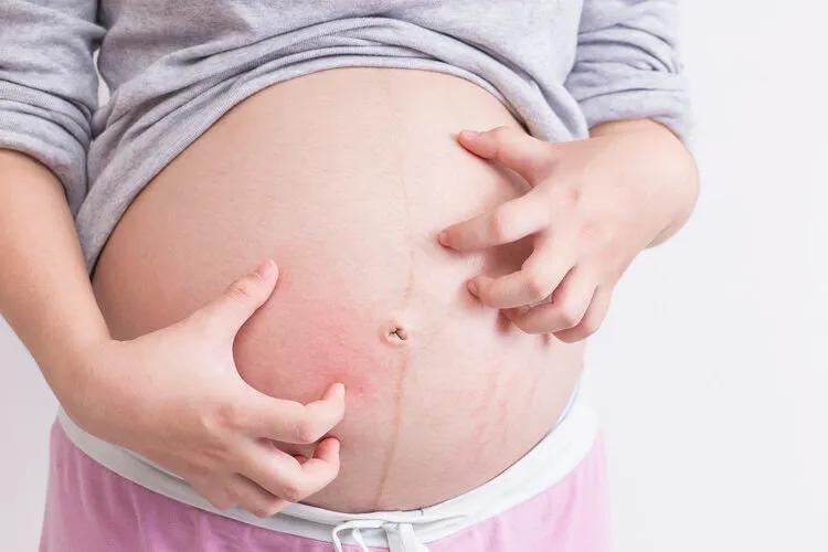 孕妇肚子上的黑线有什么用？能判断男女吗？很多人怀孕后都会出现