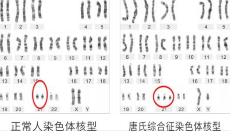 4年前广州83岁老母亲，亲手将46岁儿子杀害，不能让他死在我后面