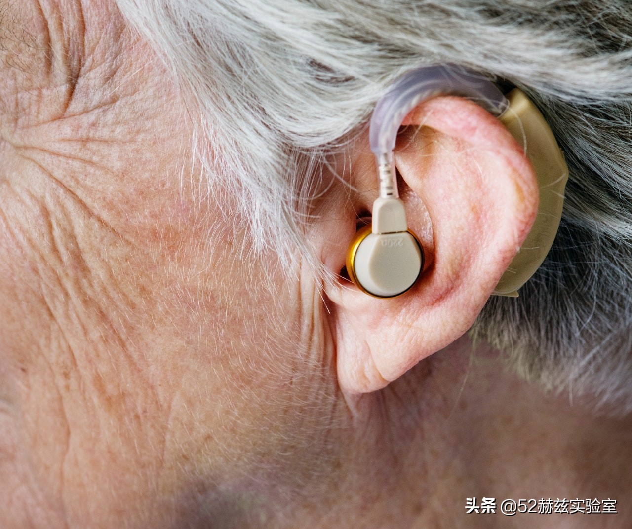 国内95%的大型医疗设备靠进口？为什么医院不愿意用国产的？