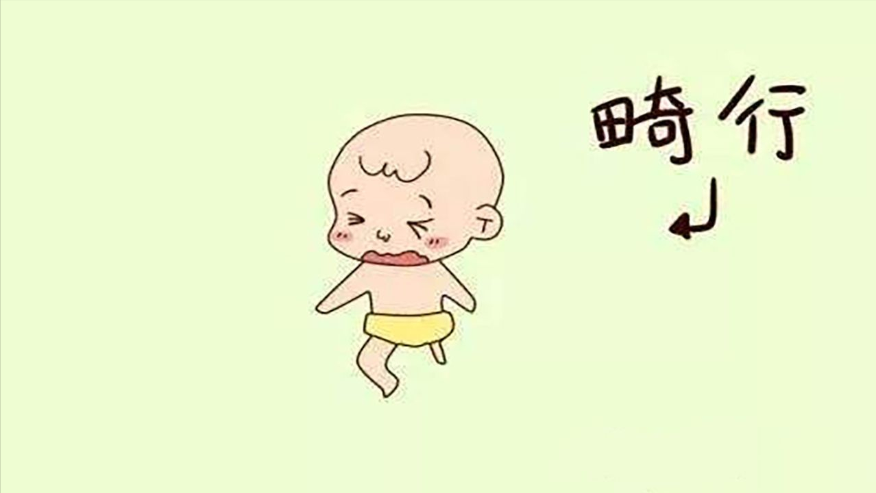 婴儿皮毛窦(新生儿的罕见病) - 乐宝宝贝