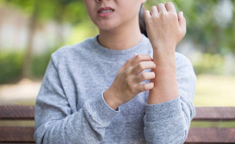 皮肤痒是肝不好？肝病引发的痒，可能还有3类皮肤表现，如何判断