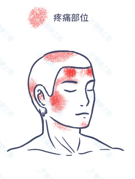 1个马上缓解头痛的方法，简单有效，还能预防颈椎病