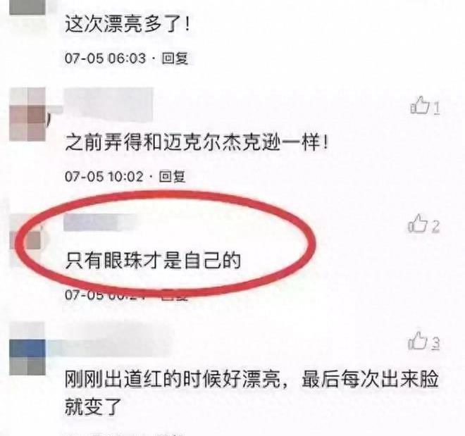曾是超女冠军,却因整容失败像“怪物”,全身只剩下眼珠是自己的