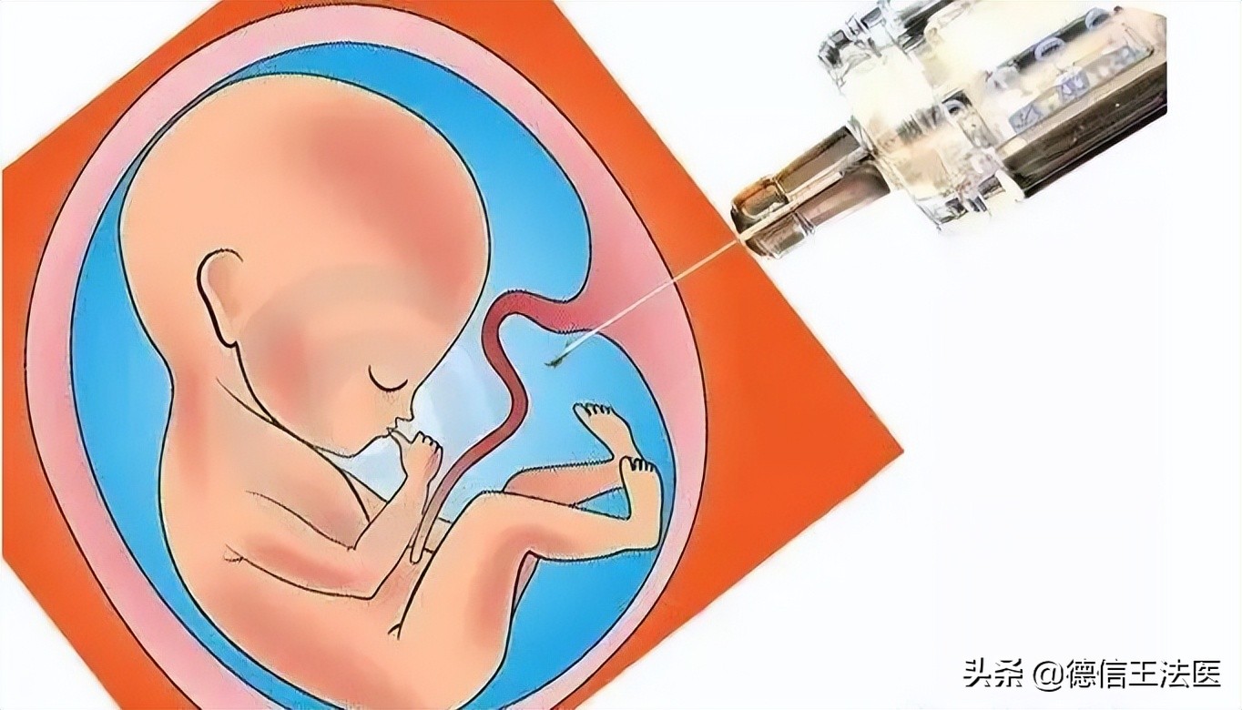 孕期可以做亲子鉴定吗(孕期亲子鉴定怎么做，孕期亲子鉴定结果准确吗？)