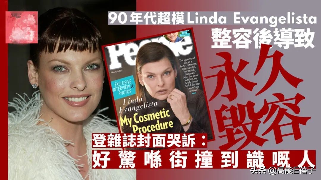 90年代超级模特的鼻祖控诉整形失败，首次公开“永久破坏”照片