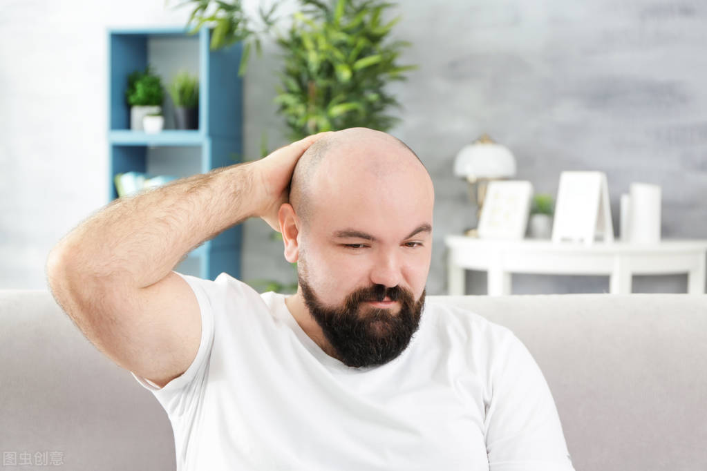 中老年男性脱发，米诺地尔、非那雄胺哪个更好？本文讲出实情