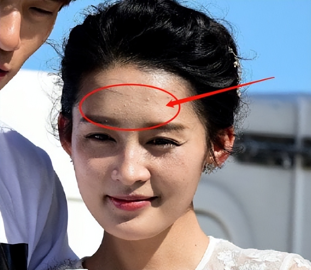 痘痘脸、赘肉、五五分！生图里的女星，让我看见了人间真实