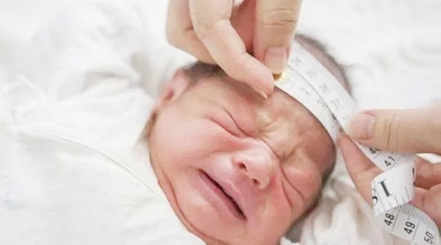 一般情况下,八斤以上就属于巨大儿,十斤则是严重超重.