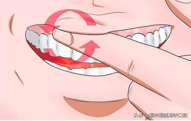 无法保留！29岁女子因牙周炎掉一大半牙！你的牙周还好吗？