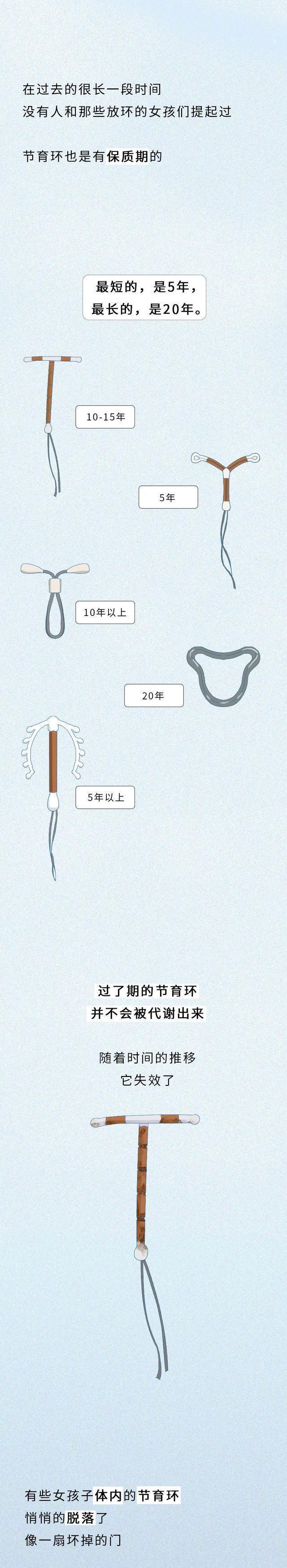 "节育环"在女性体内的变化全过程,不论男女都要认真看完